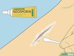 Requires trained clinician and is costly; How To Treat An Open Wound 15 Steps With Pictures Wikihow