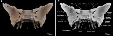 • it resembles a bat with outstretching wings. Photography Posterior View Of The Sphenoid Bone This Posterior View Download Scientific Diagram