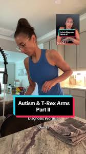 Replying to @Em Mitch Autism & T-Rex Arms 🦖 I will also add that this can  be related to hypermobility which is exhibited by over 50% of the  neurodivergent population as opposed to just 20% of the ...