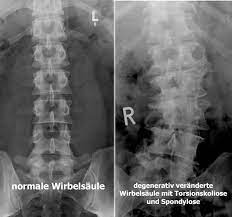 Check spelling or type a new query. Prof Dr Christian Woiciechowsky Neurochirurgie Berlin Symptomcheck
