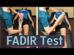 Image result for FADIR Test