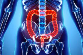 Increasing incidence of colorectal cancer in young adults. Under Age 50 4 Tips To Help You Avoid Colon Cancer Health Essentials From Cleveland Clinic