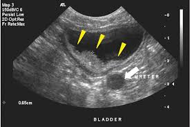 We see those in dogs also. Canine Transitional Cell Carcinoma Clinician S Brief