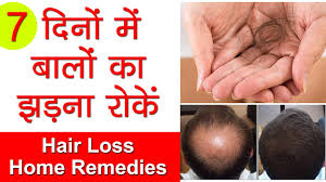 These are two best home remedies for hair loss treatments that actually work in male pattern baldness symptoms and female baldness pattern symptoms simultaneously. How To Stop Hair Fall Cure Hair Loss Grow Long Hair Ganjepan Ka Ilaaj With Onion Home Remedies Youtube