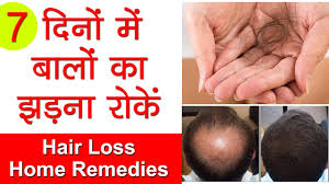 Also, according to research, aloe vera gel and lemon juice for hair growth are excellent remedies for long and still work perfectly fine till data. How To Stop Hair Fall Cure Hair Loss Grow Long Hair Ganjepan Ka Ilaaj With Onion Home Remedies Youtube