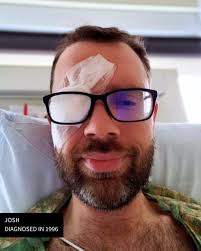 Changing the world for people living with MS isn't something we can do  alone, but when we work together, we are unstoppable. Every effort counts. Rick  McDermott, a member of the Society's