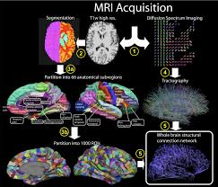 Whole Brain Structural Connectivity Network Large Jpg 3652 3127 Nejrony Svyaz Proekty