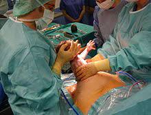 The baby is taken out through the mother's abdomen. Caesarean Section Wikipedia