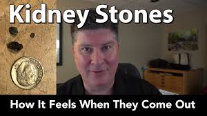 Kidney Stones What It S Like When They Come Out Youtube