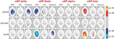 One-Year Follow-Up of Healthy Older Adults with Electroencephalographic  Risk for Neurocognitive Disorder After Neurofeedback Training