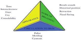 Image result for Pediatric Assessment Triangle