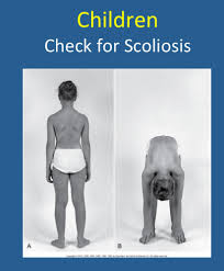 Test Musculoskeletal Exam 2 Health Assessment Quizlet