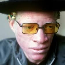 He is 65 years old and is a capricorn. Yellowman Galong Galong Galong Lyrics Genius Lyrics