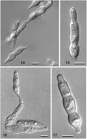 Image result for Dacryotrichia