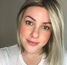 Alopecia: 'I decided I'd had enough of hiding my real self'