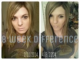 Her before and after image on the right is astounding. Sona Avedian Fotos Facebook
