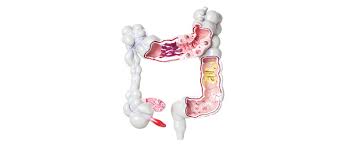 Colon cancer is the third most common cancer in men and women in the u.s. Long Term Results Of Eortc Trial For Patients With Resectable Liver Metastases From Colorectal Cancer 2021 Eortc Eortc