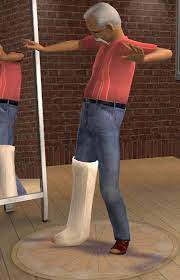 Here we have listed our favorite . Mod The Sims Right Leg Plaster Watch Them Limp All Ages Both Sexes