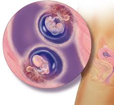 Maybe you would like to learn more about one of these? ÙƒÙŠÙ ÙŠÙ†Ù…Ùˆ Ø§Ù„ØªÙˆØ£Ù… ØµÙˆØ± Ù…ÙˆØ³ÙˆØ¹Ø©