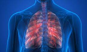 New therapeutic target identified for pulmonary fibrosis