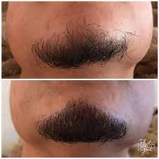 Good news for all you soul patch aficionados: Men Do You Have Facial Hair Patches That Drive You Crazy We Have An Answer Microblading Can Get You That Beard Or Mustache You Have