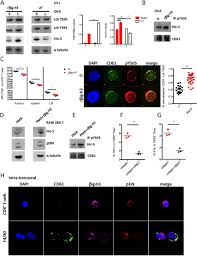 Selain itu juga, pixel experience rom merupakan cusrom terbaik untuk meningkatkan kinerja dan performa ponsel android karena di desain khusus dan selalu di optimalkan. Stromal Protein Big H3 Reprogrammes Tumour Microenvironment In Pancreatic Cancer Gut