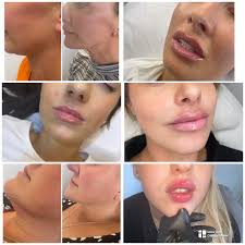 SK Aesthetics & Wellness