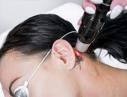 Tattoo removal cost pensacola fl. Laser Tattoo Removal Pensacola Minimally Invasive Tattoo Removal Florida