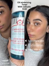 Top 4 Must-Have Toners for Glowing Skin