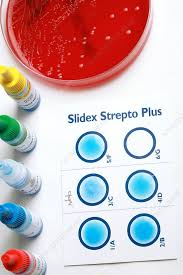 Image result for Group D Streptococcus