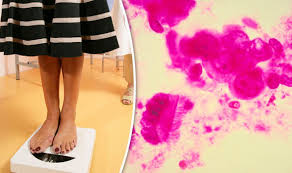 Breast pain after menopause is a general term used to mean discomfort, sensitivity, or pain in one or both mammary glands when touched or pressured. Losing Weight After Menopause Could Lower Breast Cancer Risk Express Co Uk
