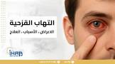 دكتور إيهاب عبد العزيز