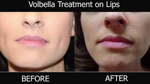 Volbella in Reno, Sparks & Hidden Valley, NV Reno NV