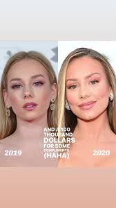 Ester Exposito Lips Before After