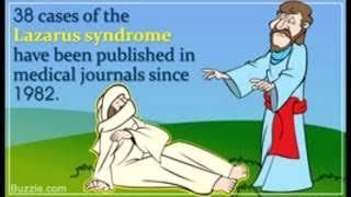 All About the Lazarus Syndrome