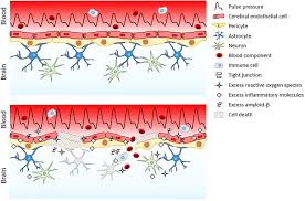 Image result for Pulse Pressure