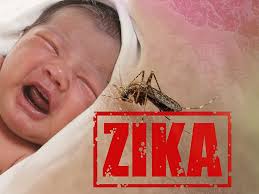 Image result for zika virus