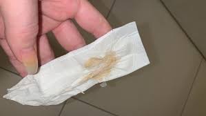 More images for pink mucus 7 weeks pregnant » Tmi Sorry Mucus Plug Or Just Discharge Mumsnet