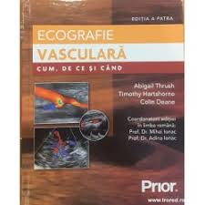 Ecografie vasculara Cum, de ce si cand