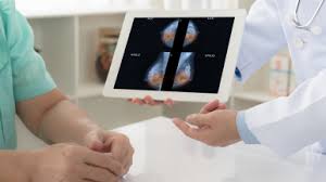 What happens when the mammogram shows enlarged lymph nodes? What Happens After A Screening Mammogram Callback