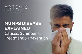 Image result for Mumps