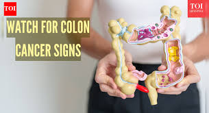 Image result for Constipation in Cancer