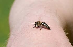 Bienenstiche Behandeln 5 Hausmittel