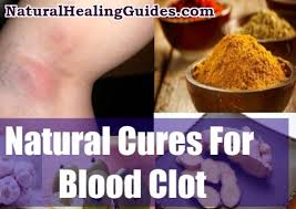 Swelling, redness and warmth are other common signs of blood clots. Healthy Life Series Episode 3 11 Effective Ways To Cure Blood Clots Naturally