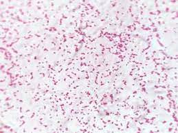 The genus salmonella, which belongs to the family enterobacteriaceae, was named after daniel e. 3 Shows Gram Negative Bacteria Of Salmonella Spp After Staining By Download Scientific Diagram