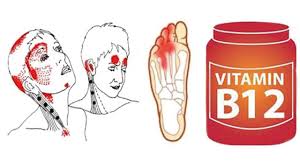 Anzeichen Eines Vitamin B12 Mangels Solltest Du Nicht Ignorieren Youtube