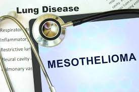 Early symptoms of mesothelioma are more often caused by other things, so at first people may ignore them or mistake them for common, minor ailments. Mesothelioma Lawyers Nyc Nyc Personal Injury Lawyers