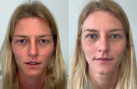 Gallery — DR BENJAMIN BURT