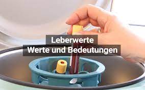Leberwerte Komplette Ubersicht Bedeutungen Praktischarzt