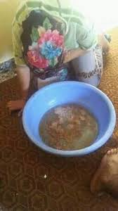 لابد من عرض الأمر على طبيب متخصص في مجال الجهاز الهضمي، وإجراء بعض الفحوصات، منها التنظير المعوي، والتصوير الملون للمريء، مع فحص للحساسية، فقد تكون الأعراض؛ بسبب ارتداد الطعام من المعدة إلى المريء، أو بسبب التهابات في المعدة، وأحياناً بسبب وجود فتق معوي، أو تحسس من بعض. Facebook